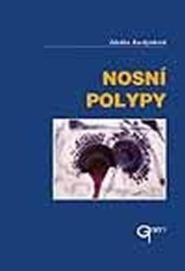 Obrázok Nosní polypy