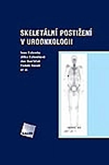 Obrázok Skeletální postižení v uroonkologii
