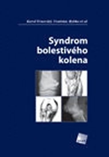 Obrázok Syndrom bolestivého kolena