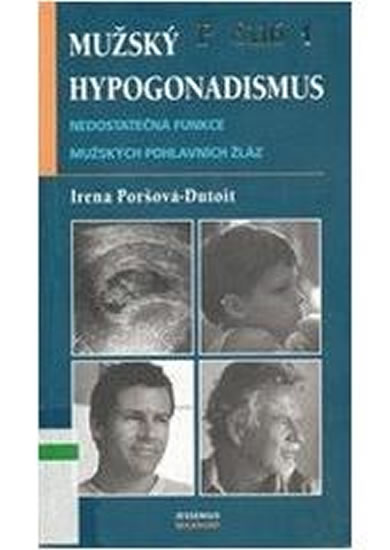 Obrázok Mužský hypogonadismus - Nedostatečná funkce mužských pohlavních žláz
