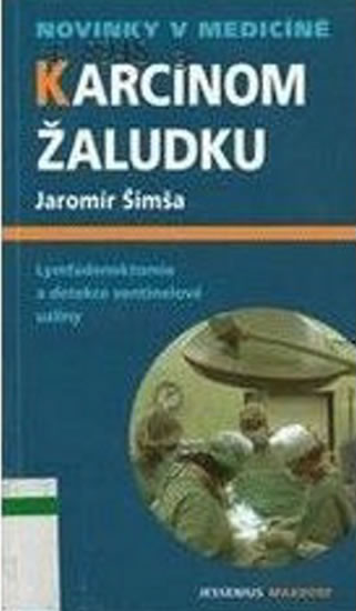 Obrázok Karcinom žaludku - Lymfadenektomie a det