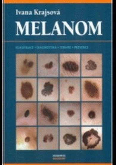 Obrázok Melanom