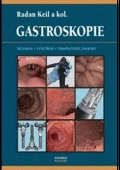 Obrázok Gastroskopie