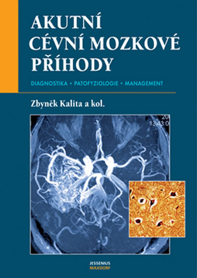Obrázok Akutní cévní mozkové příhody