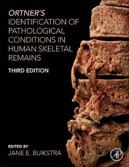 Obrázok Ortner´s Identification of Pathological