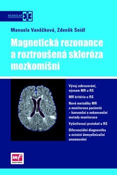 Obrázok Magnetická rezonance a roztroušená skleróza mozkomíšní