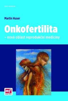 Obrázok Onkofertilita