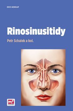 Obrázok Rinosinusitidy