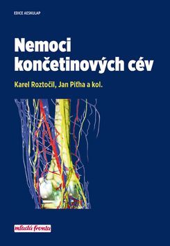 Obrázok Nemoci končetinových cév