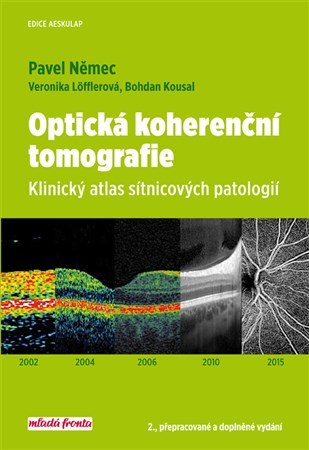 Obrázok Optická kohereční tomografie