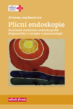 Obrázok Plicní endoskopie