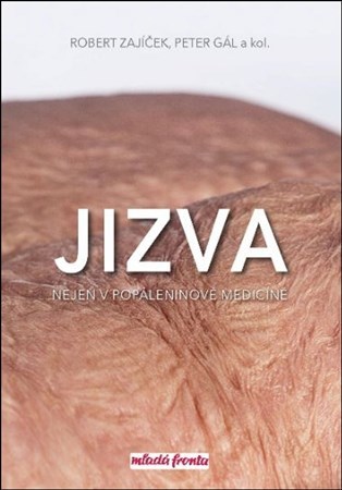 Obrázok Jizva nejen v popáleninové medicíně