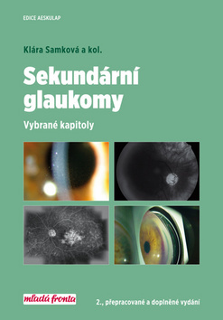 Obrázok Sekundární glaukomy - Vybrané kapitoly - 2.vydání