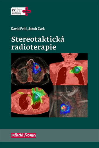 Obrázok Stereotaktická radioterapie