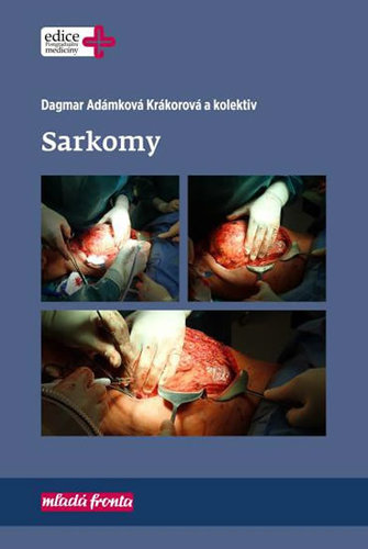 Obrázok Sarkomy