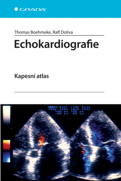 Obrázok Echokardiografie