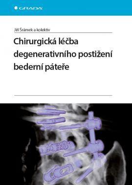 Obrázok Chirurgická léčba degenerativního postižení bederní páteře