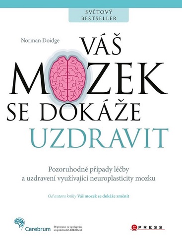 Obrázok Váš mozek se dokáže uzdravit