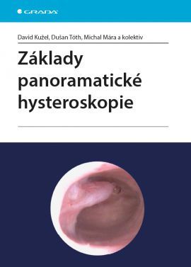 Obrázok Základy panoramatické hysteroskopie