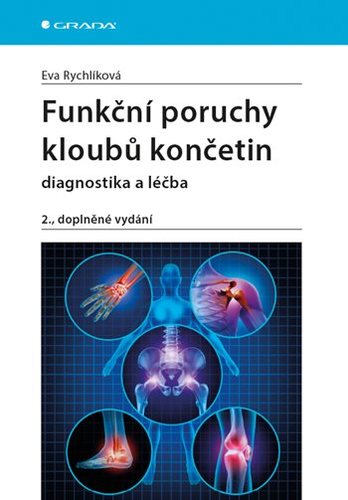 Obrázok Funkční poruchy kloubů končetin