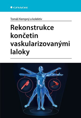 Obrázok Rekonstrukce končetin vaskularizovanými laloky