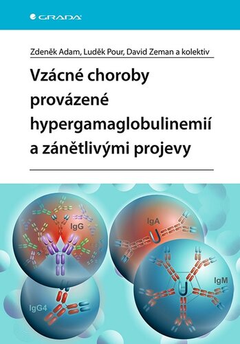 Obrázok Vzácné choroby provázené hypergamaglobulinemií a zánětlivými projevy