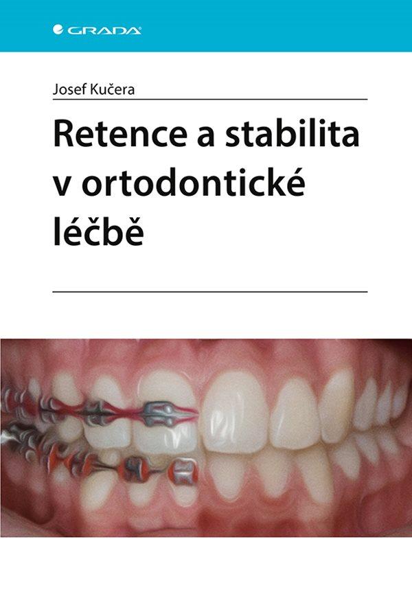 Obrázok Retence a stabilita v ortodontické léčbě