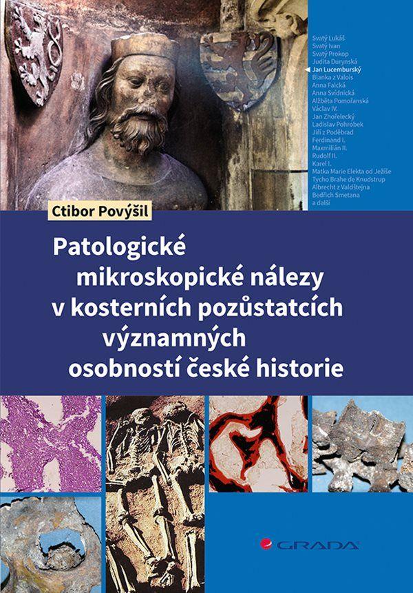 Obrázok Patologické mikroskopické nálezy v kosterních pozůstatcích významných osobností české historie