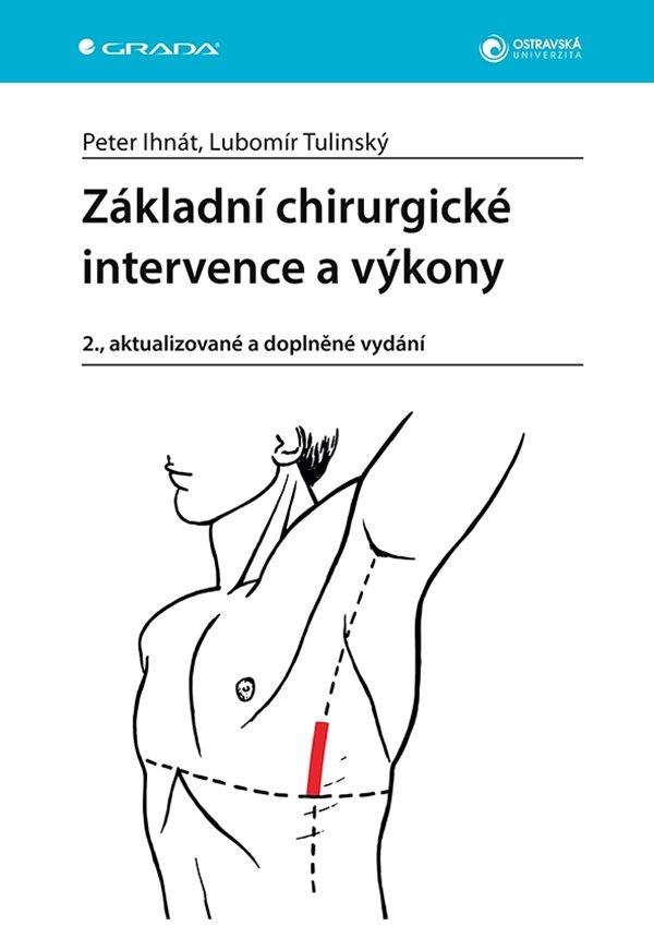 Obrázok Základní chirurgické intervence a výkony