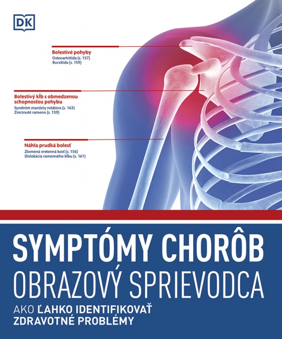 Obrázok Symptómy chorôb. Obrazový sprievodca