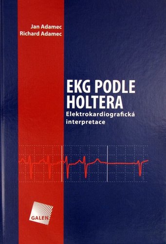Obrázok EKG podle Holtera: Elektrokardiografická