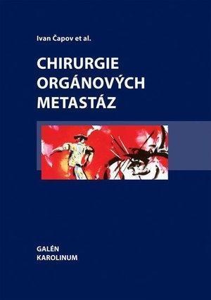 Obrázok Chirurgie orgánových metastáz