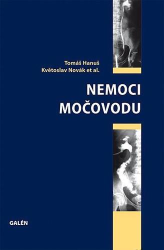 Obrázok Nemoci močovodu
