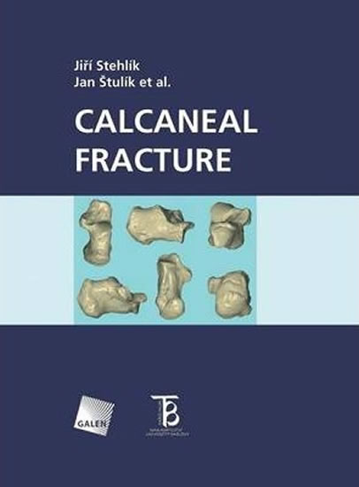 Obrázok Calcaneal fracture