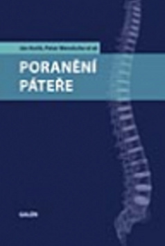 Obrázok Poranění páteře