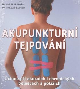 Obrázok Akupunkturní tejpování - Účinné při akutních i chronických bolestech a potížích