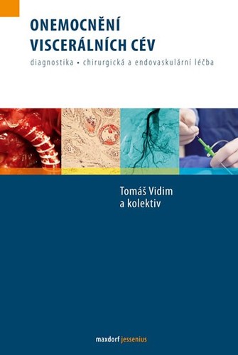 Obrázok Onemocnění viscerálních cév