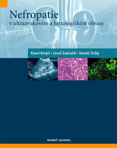 Obrázok Nefropatie v ultrazvukovém a histologickém obraze