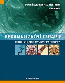 Obrázok Rekanalizační terapie - Akutní ischemické cévní mozkové příhody