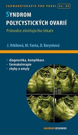 Obrázok Syndrom polycystických ovarií