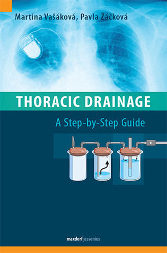 Obrázok Thoracic Drainage / A Step-by-Step Guide