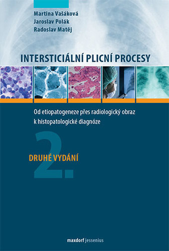 Obrázok Intersticiální plicní procesy - Od etiopatogeneze přes radiologický obraz k histopatologické diagnóze