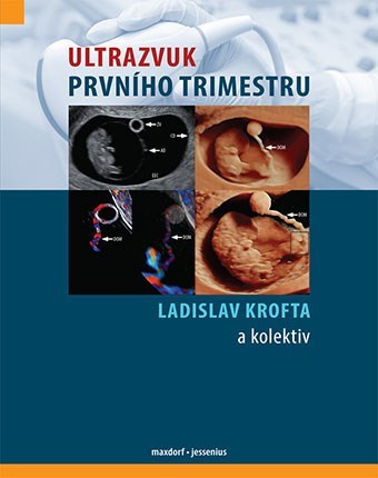Obrázok Ultrazvuk prvního trimestru