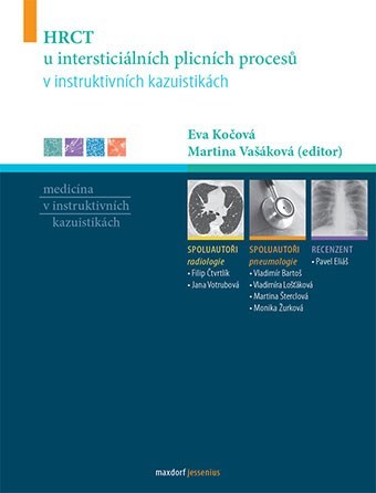 Obrázok HRCT u intersticiálních plicních procesů v instruktivních kazuistikách