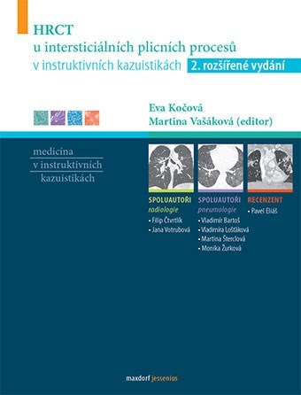 Obrázok HRCT u intersticiálních plicních procesů v instruktivních kazuistikách - 2.vydání