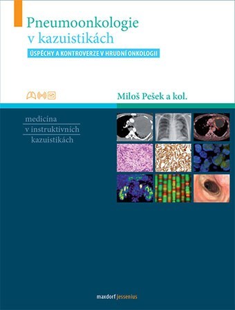 Obrázok Pneumoonkologie v kazuistikách