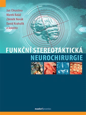 Obrázok Funkční stereotaktická neurochirurgie