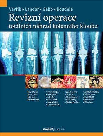 Obrázok Revizní operace totálních náhrad kolenní