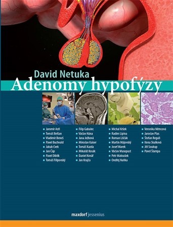 Obrázok Adenomy hypofýzy
