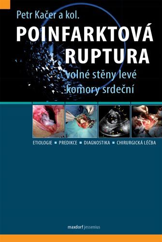 Obrázok Poinfarktová ruptura volné stěny levé komory srdeční